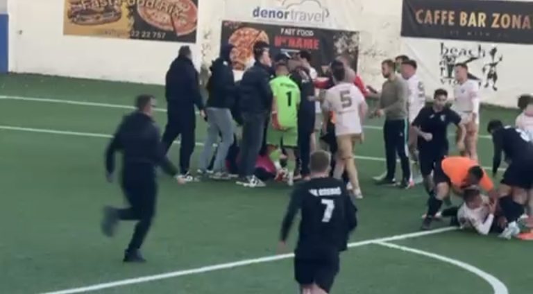 Krvava slika iz Orebića: Metković objavio fotografije ugriza i ozljeda!